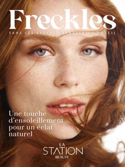 Formation Freckles La Station Beauté